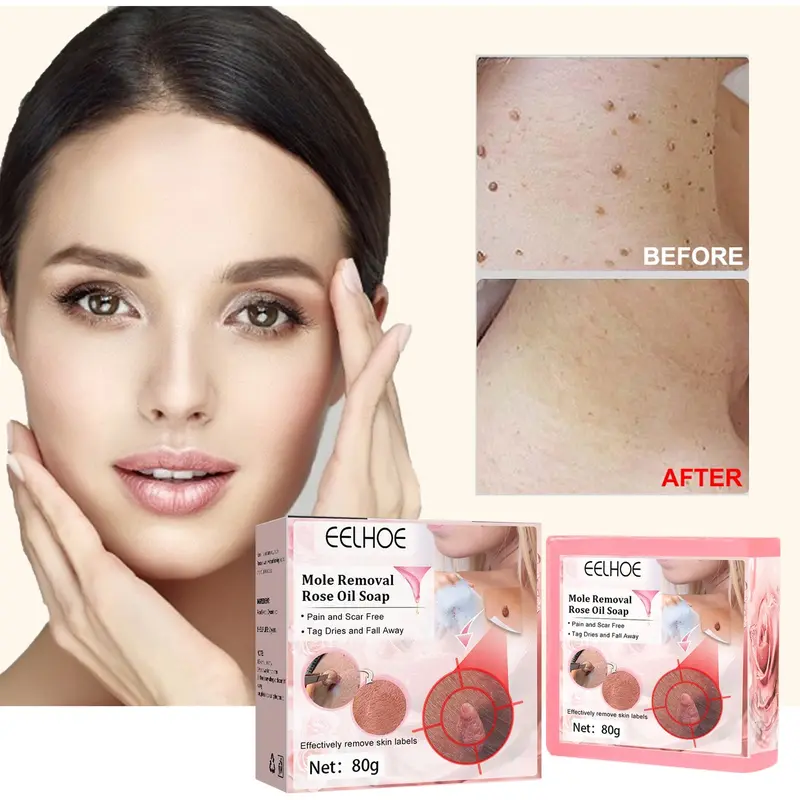 Verruca & Nevus Cleansing Soap With Rose Essential Oil For Face And Neck 1